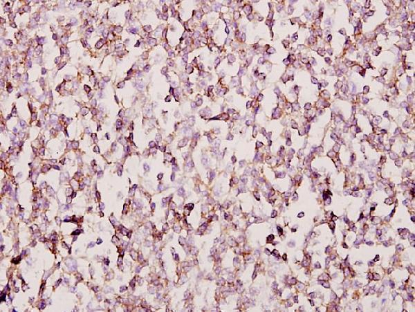 a12863 foxb1 primary antiboties ihc testing 2