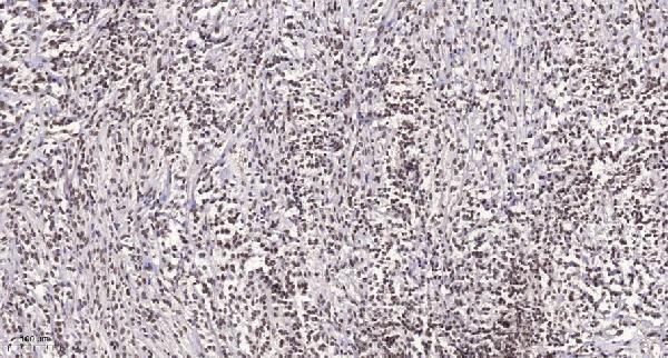 a12867 ankrd30a primary antibodies ihc testing 1