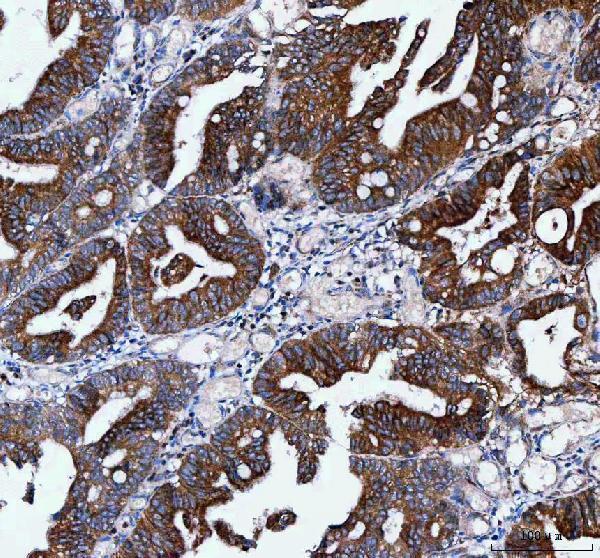  IHC analysis of IFT52 using anti-IFT52 antibody (A12872-1)
