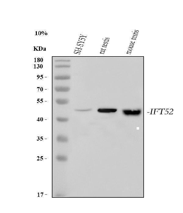  Western blot analysis of IFT52 using anti-IFT52 antibody (A12872-1)