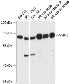 Western blot analysis of extracts of various cell lines, using VSIG1 antibody  at 1:3000 dilution