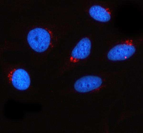a12877 1 glt8d1 primary antibodies if testing 1
