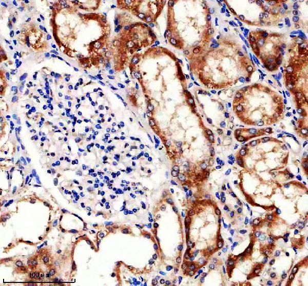IHC analysis of GLT8D1 using anti-GLT8D1 antibody (A12877-1)