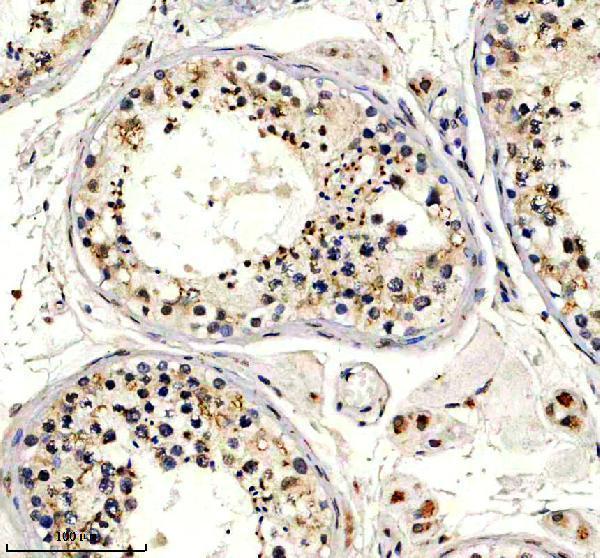 IHC analysis of GLT8D1 using anti-GLT8D1 antibody (A12877-1)