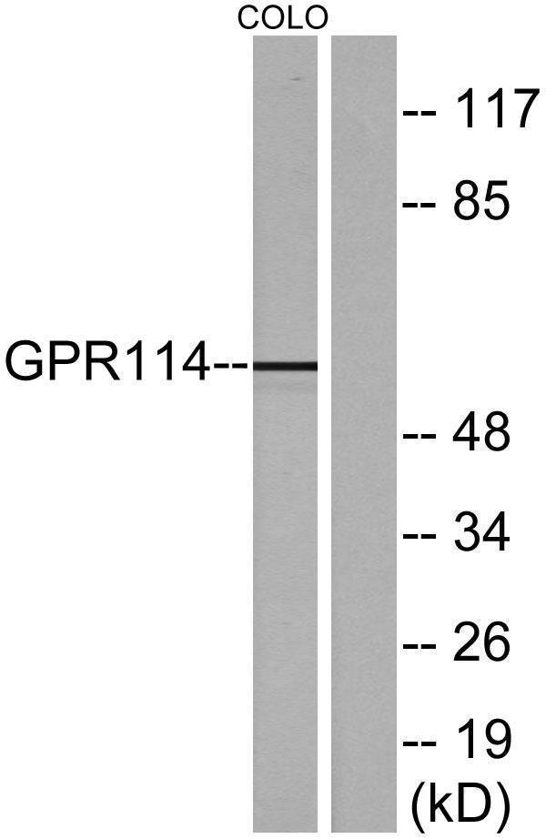 Western blot analysis of lysates from COLO205 cells, using GPR114 Antibody