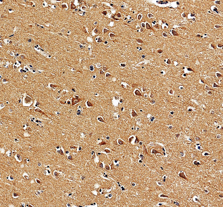 IHC analysis of IP6K3 using anti-IP6K3 antibody (A12884-1)