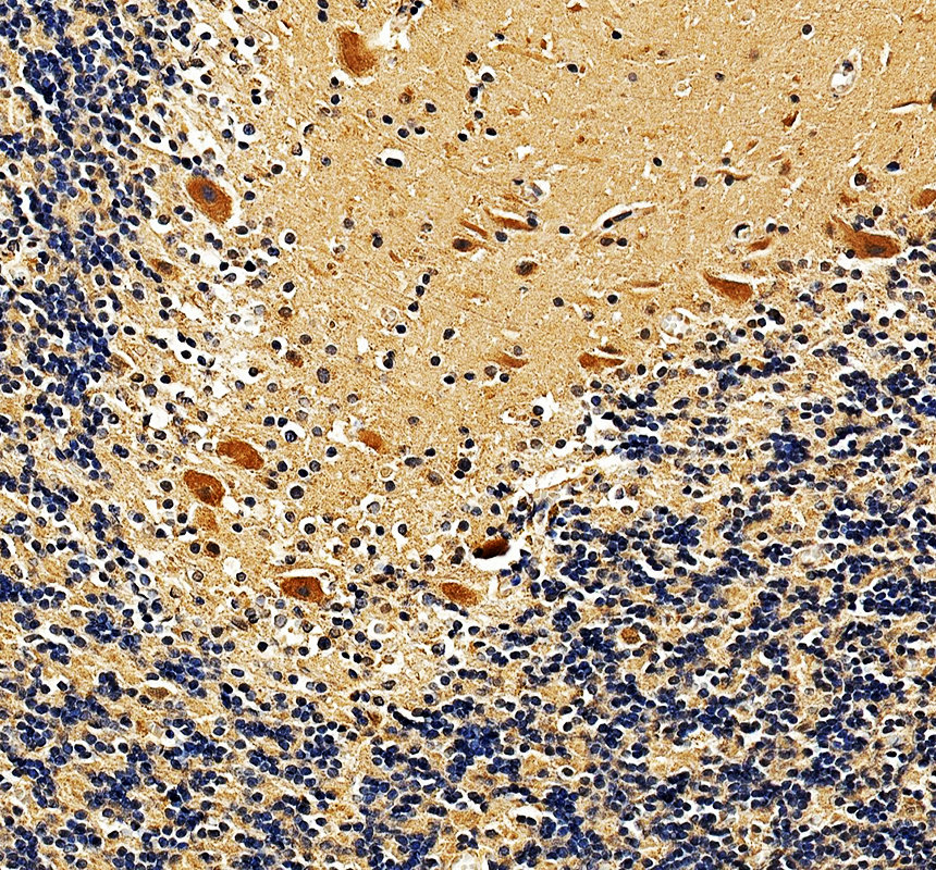 IHC analysis of IP6K3 using anti-IP6K3 antibody (A12884-1)