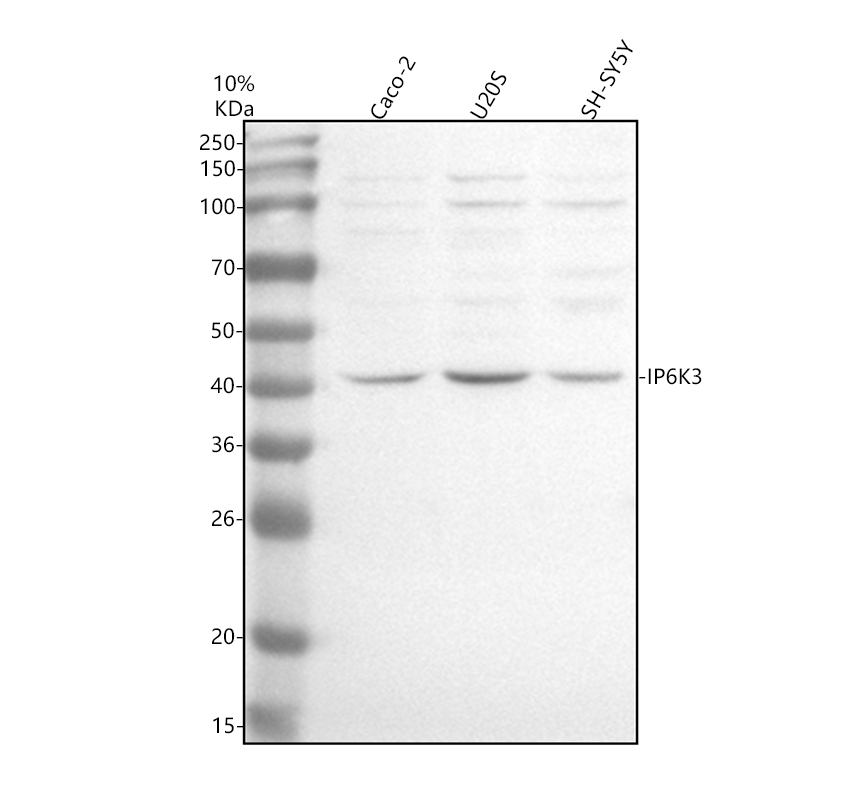 Western blot analysis of IP6K3 using anti-IP6K3 antibody (A12884-1)