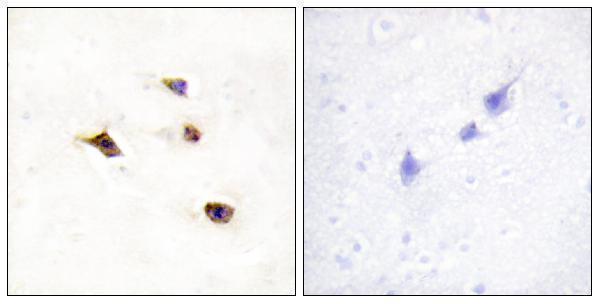 Immunohistochemistry analysis of paraffin-embedded human brain tissue, using IP6K3 Antibody