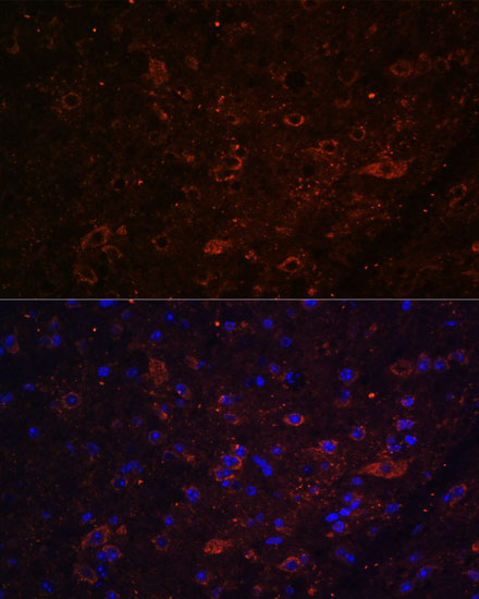 Immunofluorescence analysis of mouse brain using FSTL5 antibody  at dilution of 1:100