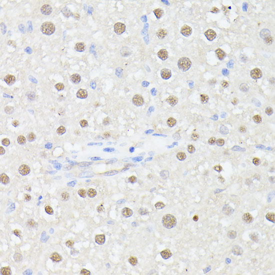 a12895 mlf2 primary antiboties ihc testing 2