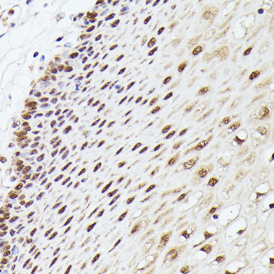 a12895 mlf2 primary antiboties ihc testing 3