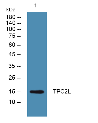 Western blot analysis of lysates from SW480 cells, primary antibody was diluted at 1:1000, 4°over night