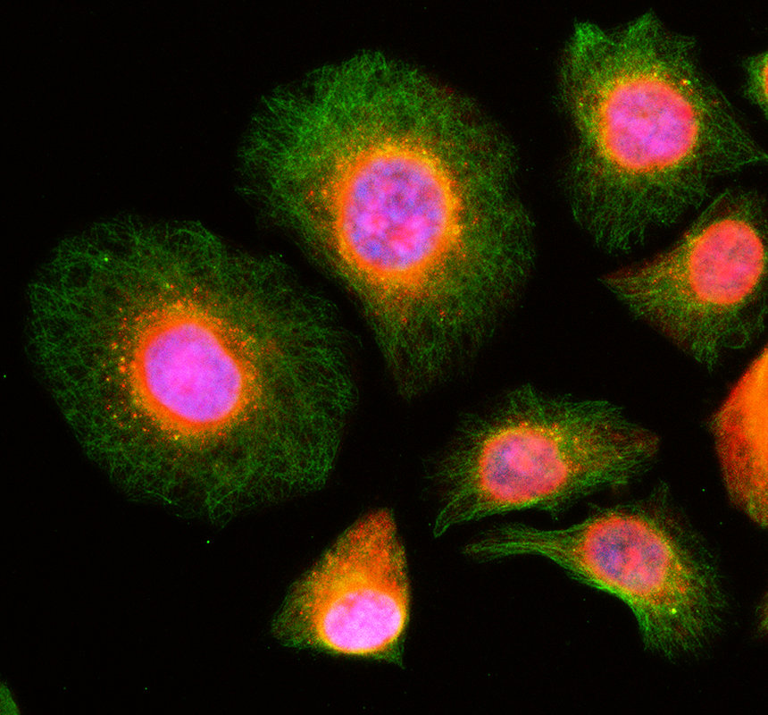 a12901 1 gal3st4 primary antibodies if testing 1