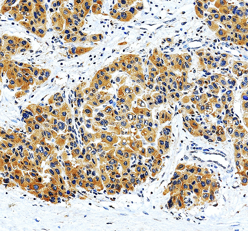 a12901 1 gal3st4 primary antibodies ihc testing 1
