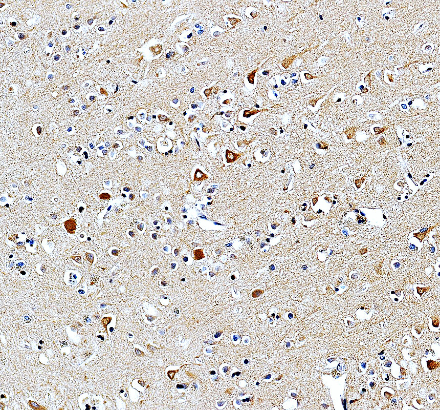 a12901 1 gal3st4 primary antibodies ihc testing 2