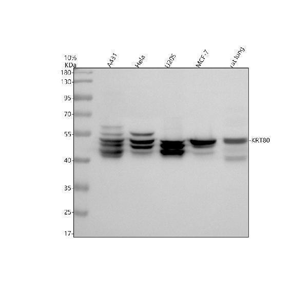 a12904 2 krt80 primary antibodies wb testing 1