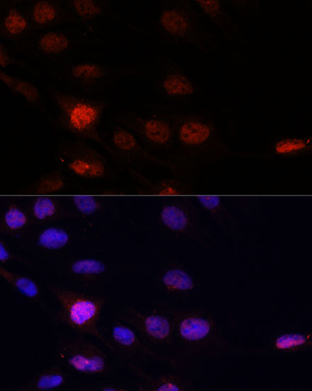 Immunofluorescence analysis of C6 cells using KLHL8 antibody  at dilution of 1:100
