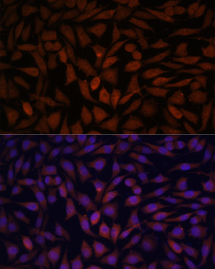 Immunofluorescence analysis of L929 cells using KLHL8 antibody  at dilution of 1:100