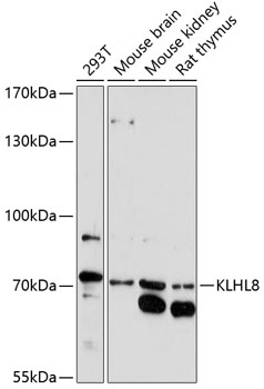Western blot analysis of extracts of various cell lines, using KLHL8 antibody  at 1:1000 dilution