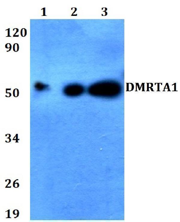 Western blot (WB) analysis of DMRTA1 polyclonal antibody at 1:500 dilution
Lane1:HEK293T whole cell lysate
Lane2:Raw264