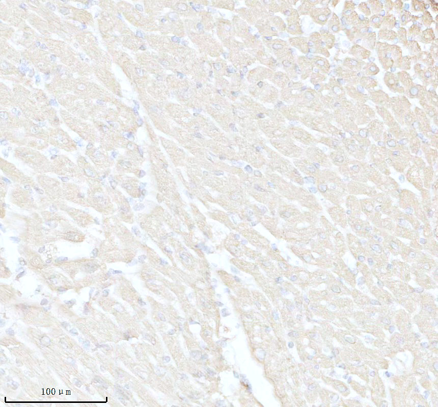 IHC analysis of MRPS27 using anti-MRPS27 antibody (A12929-1)