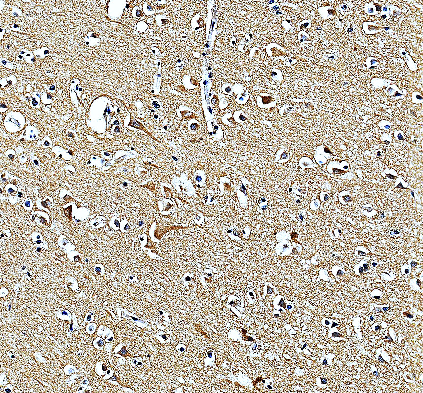 a12929 1 mrps27 primary antibodies ihc testing 3