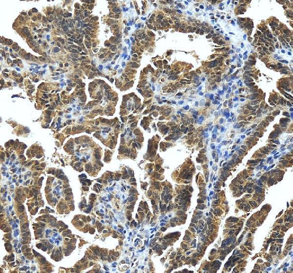 IHC analysis of STRBP using anti-STRBP antibody (A12932-1)
