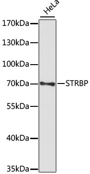 a12932 strbp primary antiboties wb testing 1