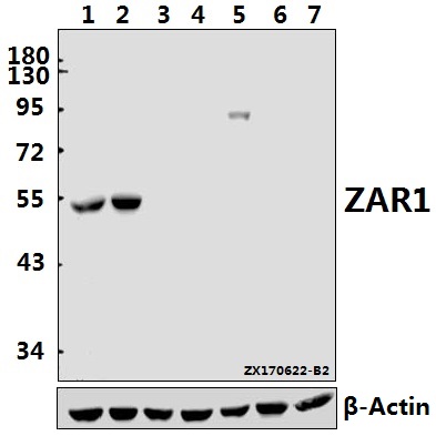 Western blot (WB) analysis of ZAR1 polyclonal antibody at 1:500 dilution
Lane1:The Testis tissue lysate of Mouse(40ug)
Lane2:The Testis tissue lysate of Rat(40ug)
Lane3:K562 whole cell lysate(40ug)
Lane4:Hela whole cell lysate(40ug)
Lane5:SGC7901 whole cell lysate(40ug)
Lane6:The Kidney tissue lysate of Mouse(40ug)
Lane7:The Kidney tissue lysate of Rat(40ug)