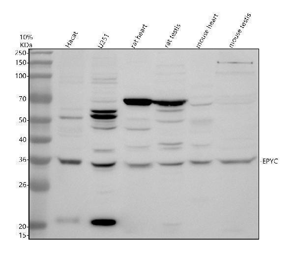 Western blot analysis of EPYC using anti-EPYC antibody (A12937-3)