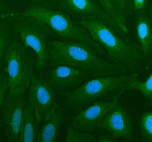 IF analysis of ETNK2 using anti-ETNK2 antibody (A12947-2)