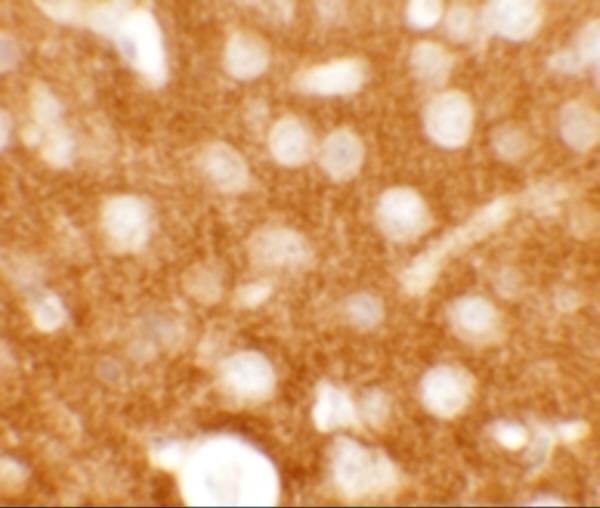 Immunohistochemistry of TMEM88 in mouse brain tissue with TMEM88 antibody at 2