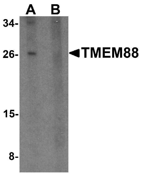 Western blot analysis of TMEM88 in human brain tissue lysate with TMEM88 antibody at 1 μg/mL in (A) the absence and (B) the presence of blocking peptide