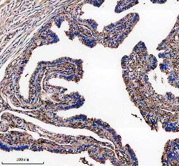 a12980 dnaaf5 primary antibodies ihc testing 1
