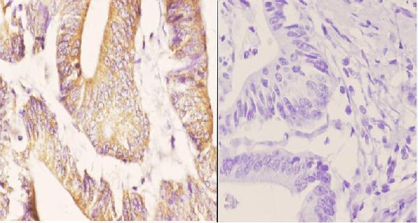 a12985 1 zc3h8 primary antiboties ihc testing 2