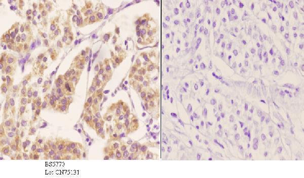 a12985 1 zc3h8 primary antiboties ihc testing 3