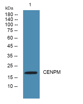 Western blot analysis of lysates from SW480 cells, primary antibody was diluted at 1:1000, 4°over night