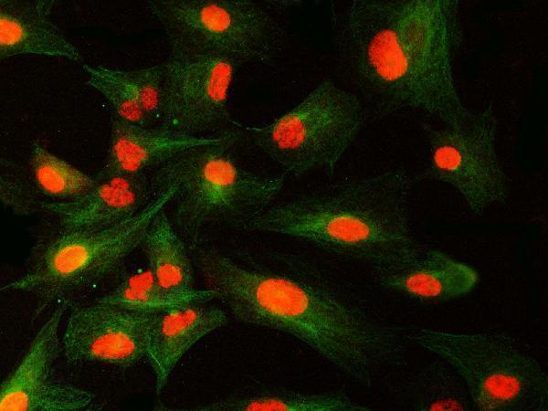 a12991 2 snrnp40 primary antibodies if testing 18