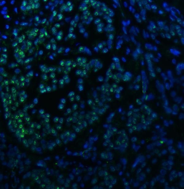 a12991 2 snrnp40 primary antibodies if testing 19