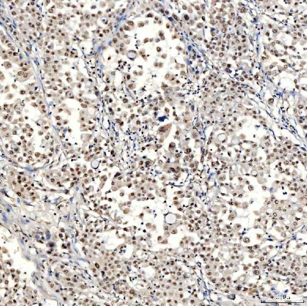 a12991 2 snrnp40 primary antibodies ihc testing 11