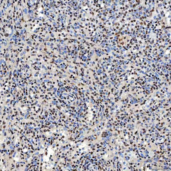 a12991 2 snrnp40 primary antibodies ihc testing 12