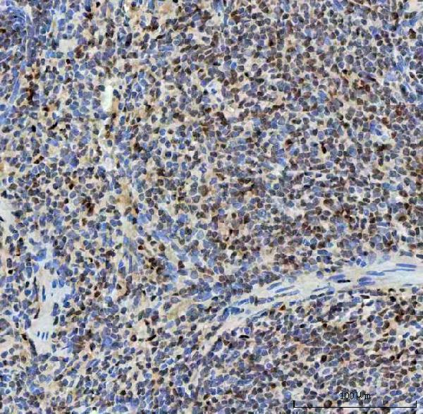 a12991 2 snrnp40 primary antibodies ihc testing 14