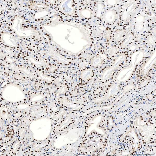 a12991 2 snrnp40 primary antibodies ihc testing 15