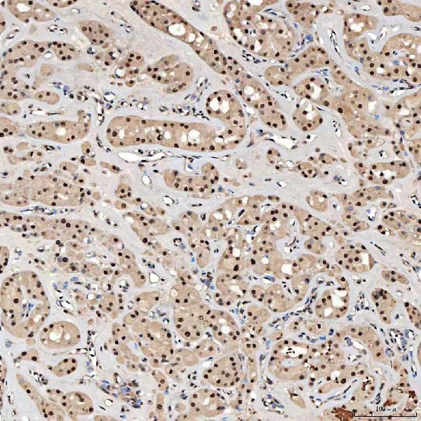 a12991 2 snrnp40 primary antibodies ihc testing 16