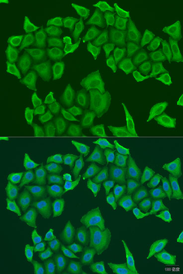 a12994 1 haus8 primary antiboties if testing 2