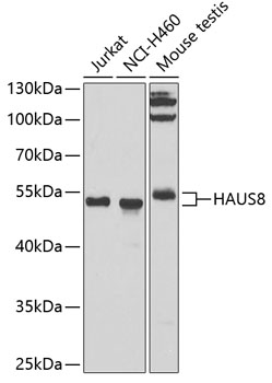 a12994 1 haus8 primary antiboties wb testing 1