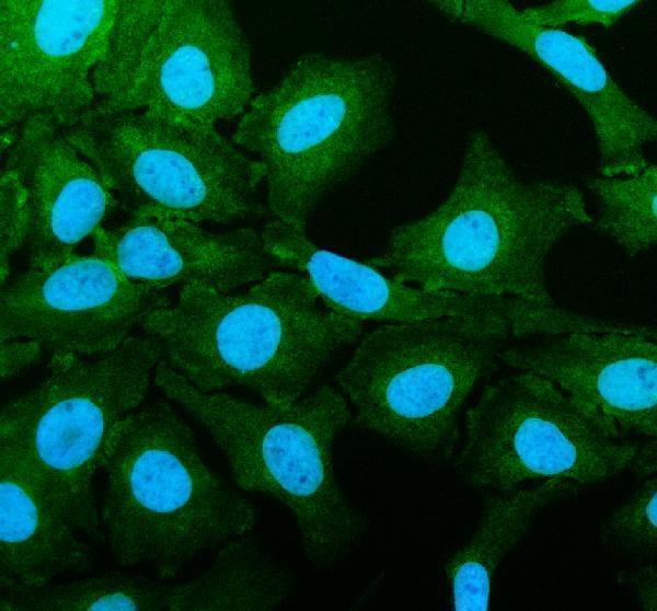 a12994 2 haus8 primary antibodies if testing 1