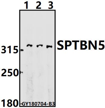 a12999 1 sptbn5 primary antiboties wb testing 1