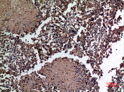 a13002 2 hspbap1 primary antibodyes ihc testing 2